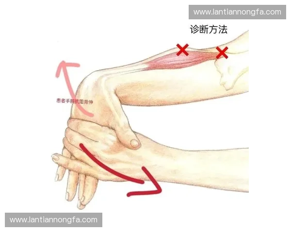 弱侧拉扯在运动损伤中的作用与康复策略分析
